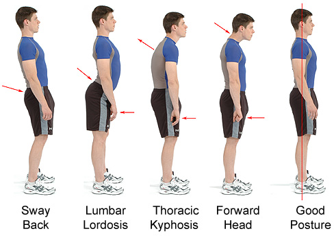 [Image: posture-chart.jpg]